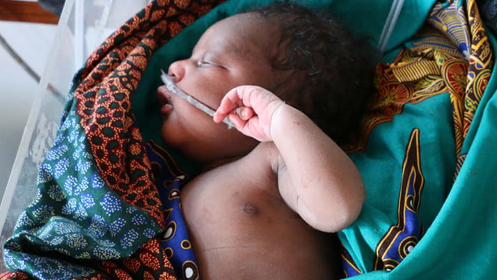a baby in Malawi, Nest 360 program